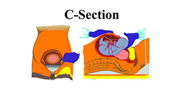 courseimage