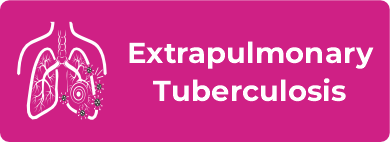Adult Extrapulmonary Tuberculosis