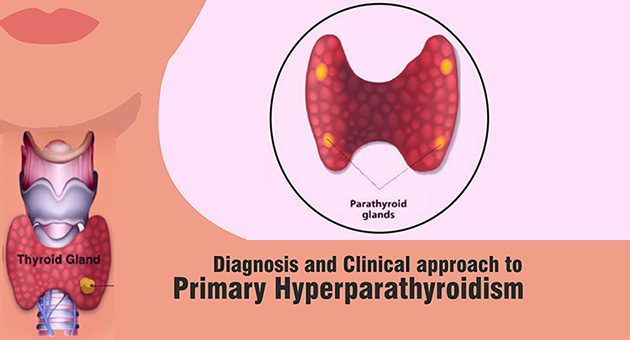 Diagnosis and Clinical Approach to Primary Hyperparathyroidism 